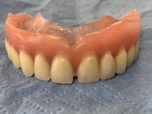 Proteză dentară totală